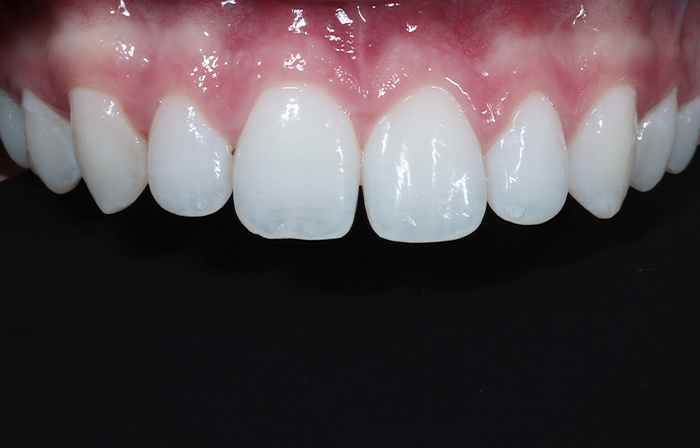 Before - Dr Ayesha Ali