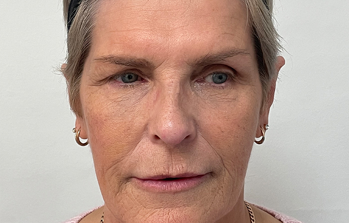 Before - Dr Ayesha Ali