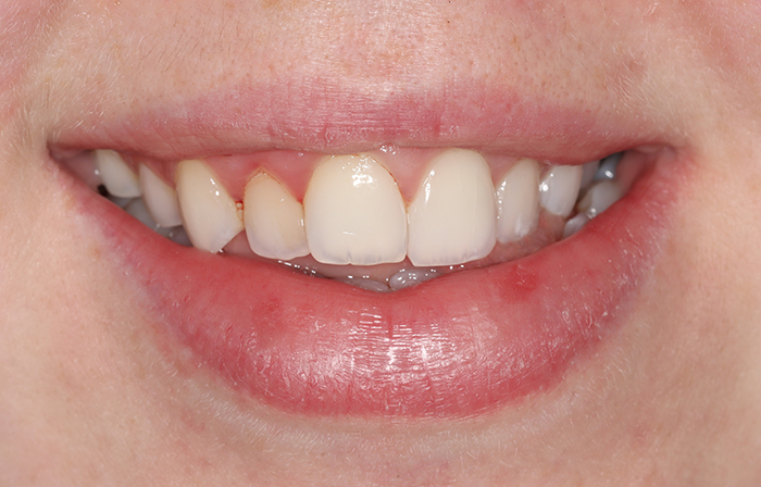 Before - Dr Ayesha Ali