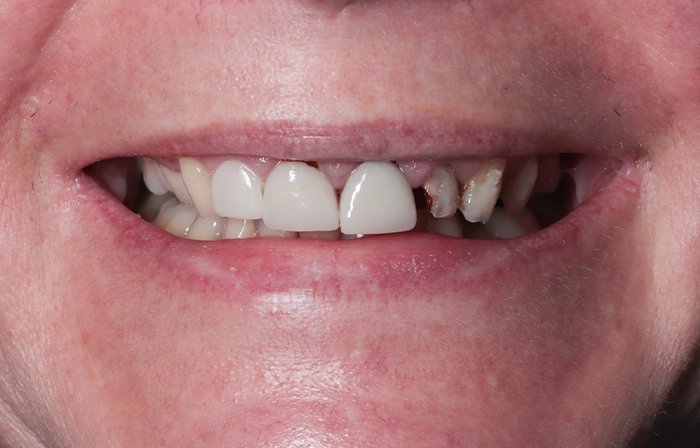 Before - Dr Ayesha Ali